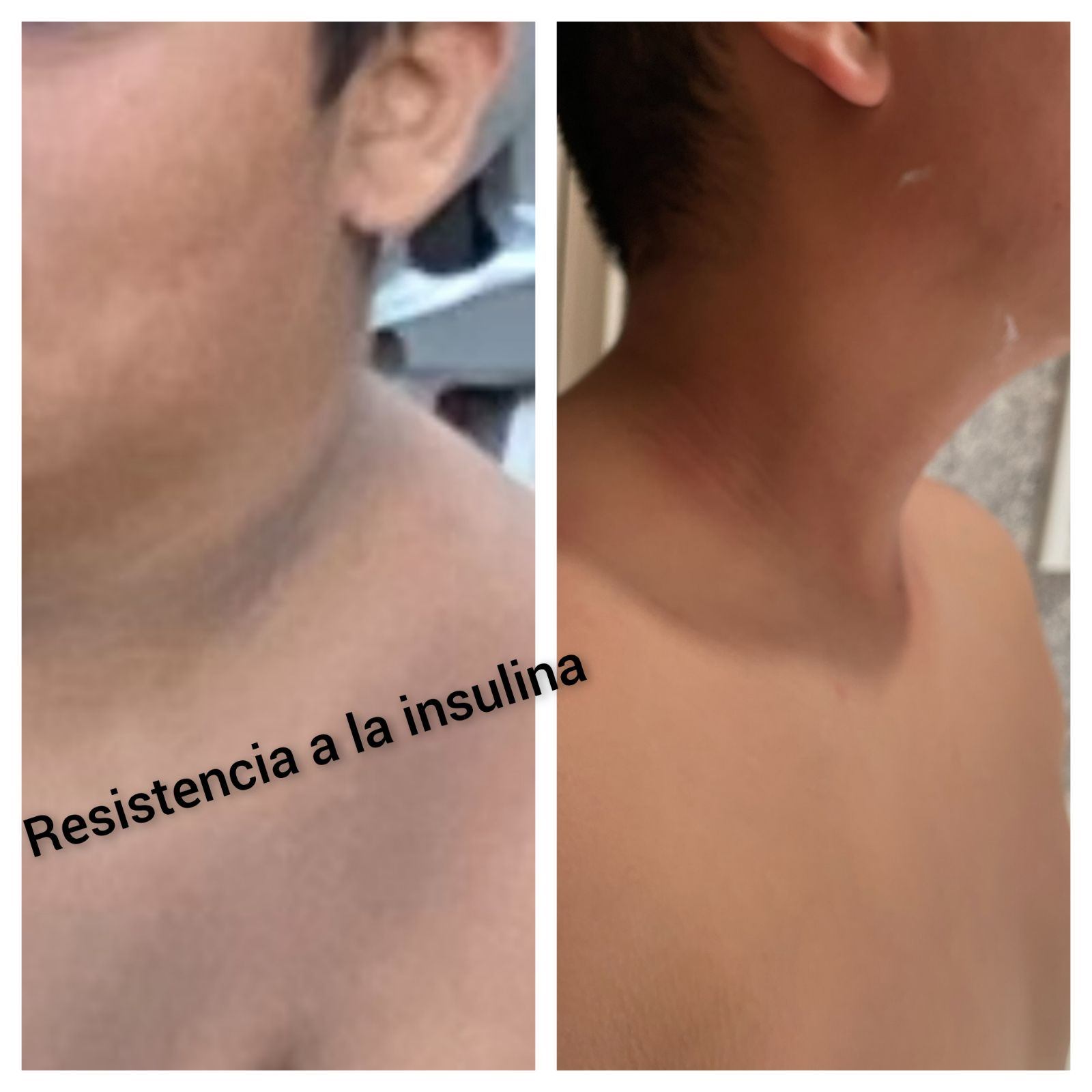 Transformacion antes y despues